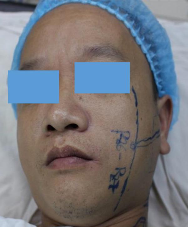 https://cdn.ncbi.nlm.nih.gov/pmc/blobs/8bc0/7925707/c247e226df7d/amjcaserep-22-e929883-g001.jpg