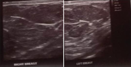 https://cdn.ncbi.nlm.nih.gov/pmc/blobs/8bc0/8051630/2977696eb3db/AJPS-17-54-g006.jpg