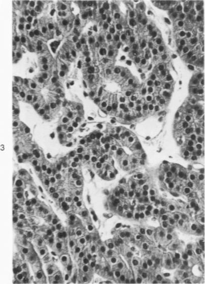 https://cdn.ncbi.nlm.nih.gov/pmc/blobs/8bc1/2018274/9068c2155c31/amjpathol00737-0135-c.jpg