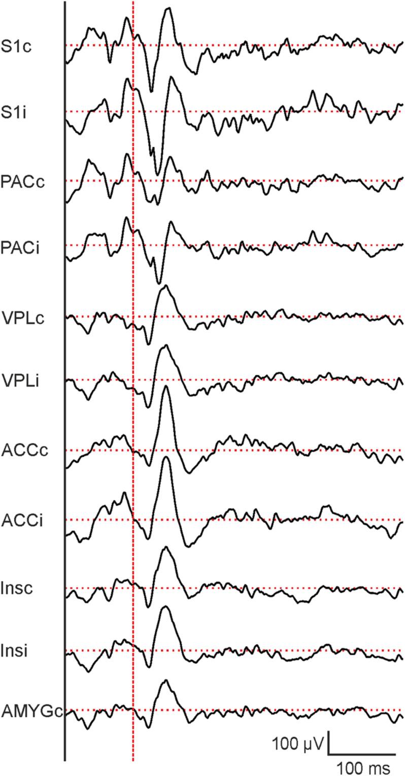 https://cdn.ncbi.nlm.nih.gov/pmc/blobs/8bc1/7907443/43a7cbb2b204/fnins-15-613801-g007.jpg