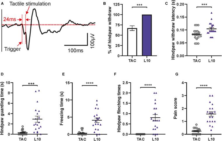 https://cdn.ncbi.nlm.nih.gov/pmc/blobs/8bc1/7907443/f17e89dcdd75/fnins-15-613801-g009.jpg