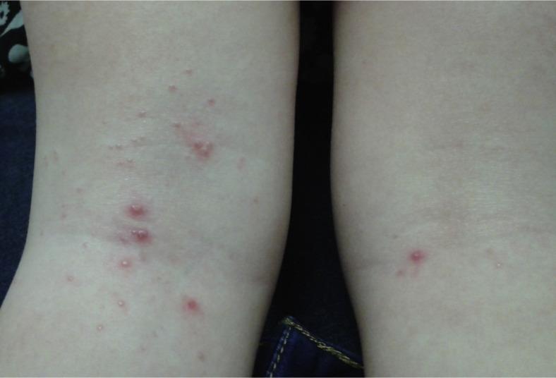 https://cdn.ncbi.nlm.nih.gov/pmc/blobs/8bc7/7411503/82aeba93bfbd/gr5_lrg.jpg