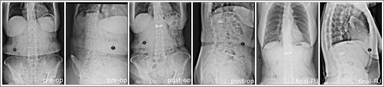 https://cdn.ncbi.nlm.nih.gov/pmc/blobs/8bcf/8725857/13b32d4be23e/JPR-14-3951-g0005.jpg