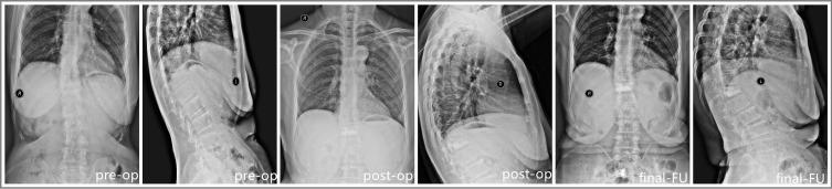 https://cdn.ncbi.nlm.nih.gov/pmc/blobs/8bcf/8725857/8aad01ae2be4/JPR-14-3951-g0004.jpg