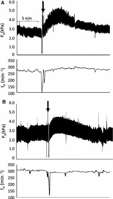 https://cdn.ncbi.nlm.nih.gov/pmc/blobs/8bd4/2940048/76ed4e6de5ef/360_2010_473_Fig1_HTML.jpg