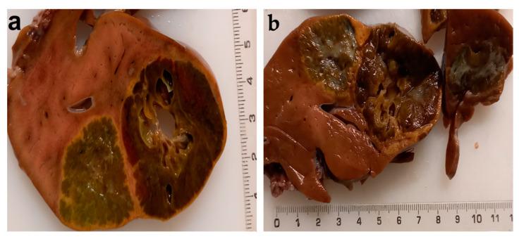 https://cdn.ncbi.nlm.nih.gov/pmc/blobs/8bd8/8947736/78c8207bd940/diagnostics-12-00758-g006.jpg