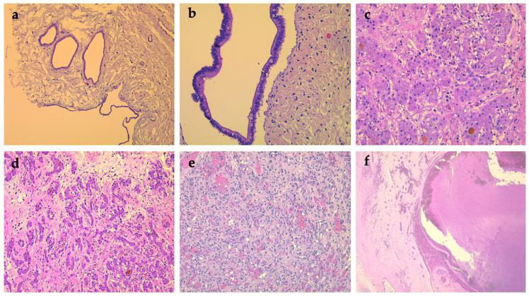 https://cdn.ncbi.nlm.nih.gov/pmc/blobs/8bd8/8947736/8519f56859f9/diagnostics-12-00758-g004.jpg