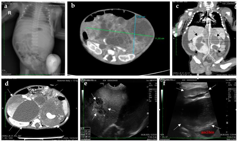 https://cdn.ncbi.nlm.nih.gov/pmc/blobs/8bd8/8947736/f7d67cd83597/diagnostics-12-00758-g002.jpg