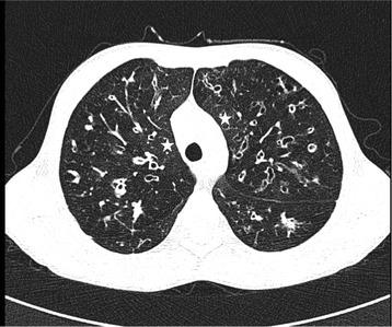 https://cdn.ncbi.nlm.nih.gov/pmc/blobs/8bdb/5964733/3384752e53c4/12890_2018_630_Fig2_HTML.jpg
