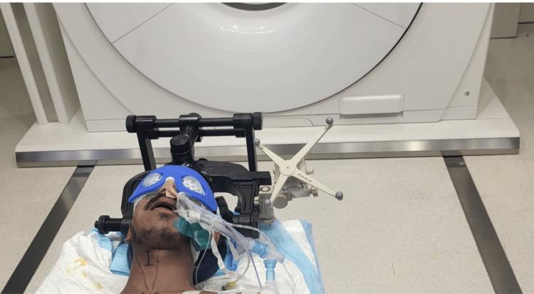 https://cdn.ncbi.nlm.nih.gov/pmc/blobs/8bdf/11638800/725dc7a9dc03/cureus-0016-00000073572-i03.jpg