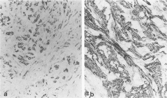 https://cdn.ncbi.nlm.nih.gov/pmc/blobs/8be3/1861656/02b6ce4479ed/amjpathol00042-0178-b.jpg