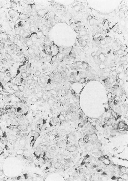 https://cdn.ncbi.nlm.nih.gov/pmc/blobs/8be3/1861656/4db64ece5004/amjpathol00042-0182-a.jpg