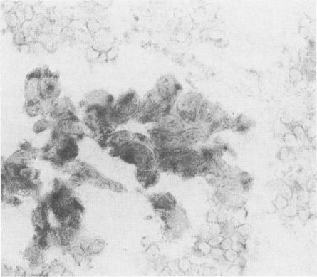 https://cdn.ncbi.nlm.nih.gov/pmc/blobs/8be3/1861656/8fea275485cb/amjpathol00042-0183-c.jpg