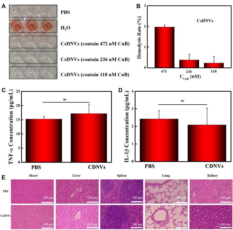 https://cdn.ncbi.nlm.nih.gov/pmc/blobs/8bef/9376005/386c0342355d/IJN-17-3583-g0005.jpg