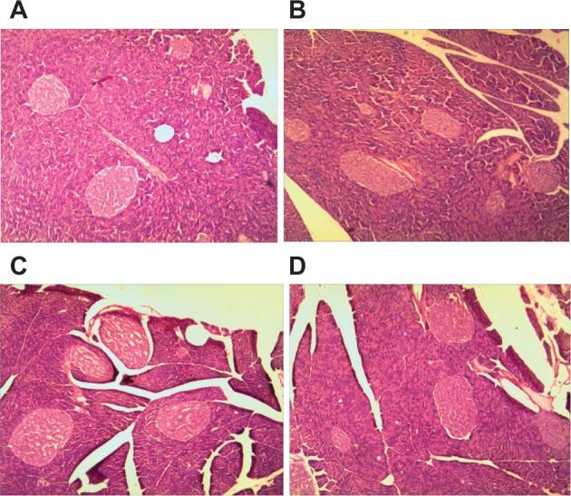 https://cdn.ncbi.nlm.nih.gov/pmc/blobs/8bf1/3862509/d3b9cd74555e/ijn-8-4677Fig9.jpg