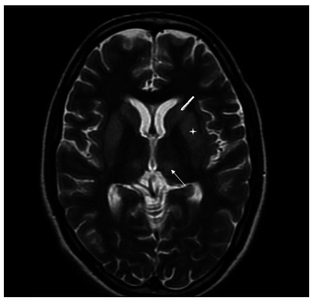 https://cdn.ncbi.nlm.nih.gov/pmc/blobs/8c03/11240856/0316b096fd87/mi-04-05-00173-g00.jpg