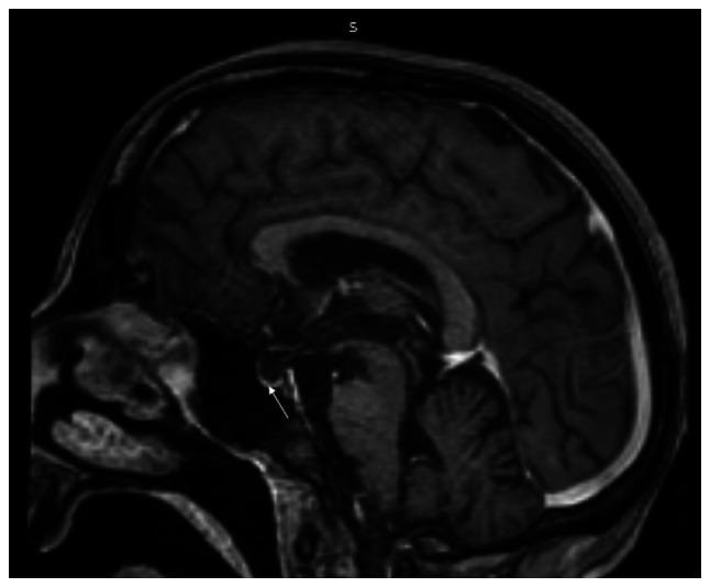 https://cdn.ncbi.nlm.nih.gov/pmc/blobs/8c03/11240856/7b18aa51250f/mi-04-05-00173-g01.jpg