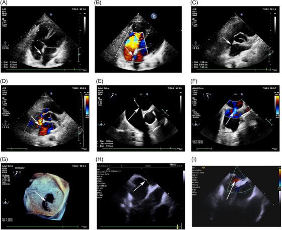 https://cdn.ncbi.nlm.nih.gov/pmc/blobs/8c05/11224996/8fbf21ab1271/MCO2-5-e631-g002.jpg