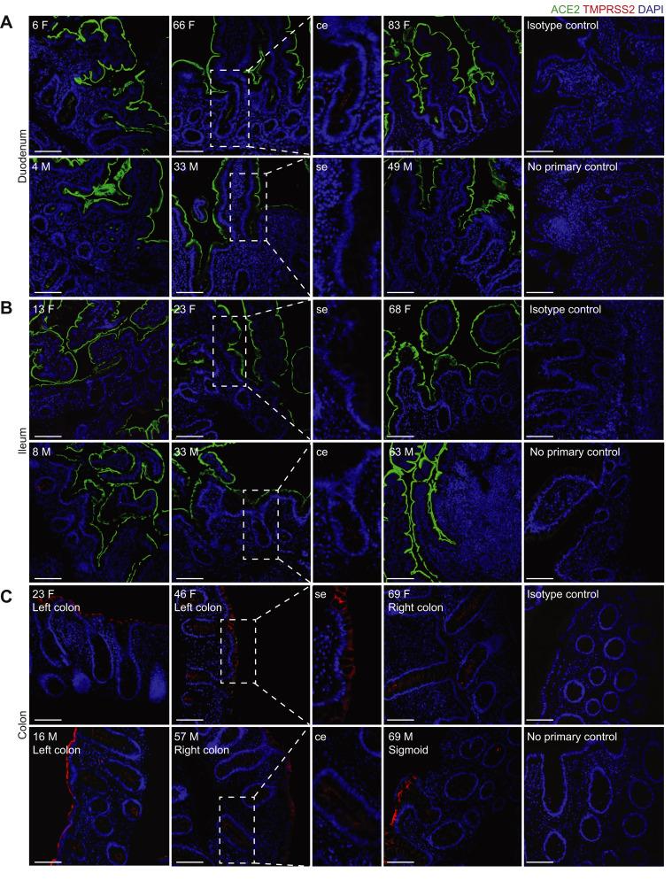 https://cdn.ncbi.nlm.nih.gov/pmc/blobs/8c07/7516468/b3b39ac39b53/fx2_lrg.jpg