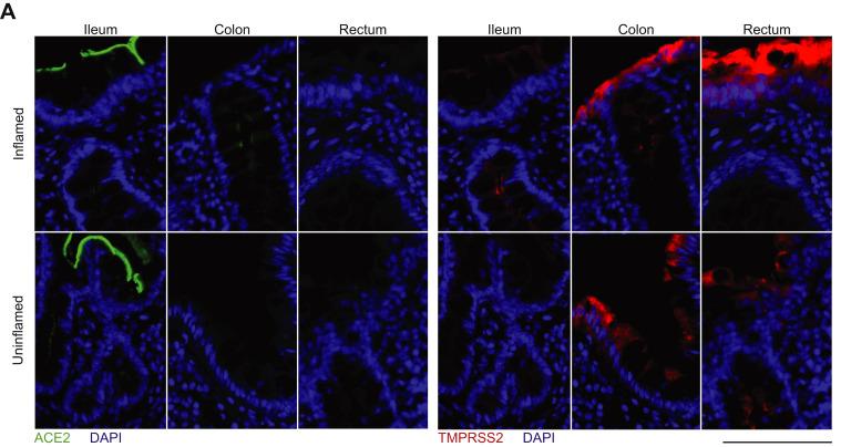 https://cdn.ncbi.nlm.nih.gov/pmc/blobs/8c07/7516468/ea7aee457dcf/fx3_lrg.jpg