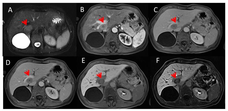 https://cdn.ncbi.nlm.nih.gov/pmc/blobs/8c09/7865653/216b1828d0d9/cancers-13-00453-g001.jpg