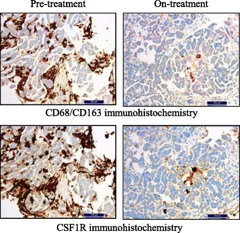 https://cdn.ncbi.nlm.nih.gov/pmc/blobs/8c13/5514481/bbdd38d7ce70/40425_2017_257_Fig2_HTML.jpg