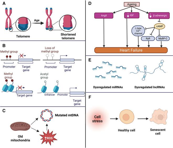 https://cdn.ncbi.nlm.nih.gov/pmc/blobs/8c1b/10073704/f60da59a6fe5/fcvm-10-1142575-g001.jpg