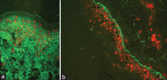 https://cdn.ncbi.nlm.nih.gov/pmc/blobs/8c1b/7982047/859f32827dd0/IDOJ-12-105-g001.jpg
