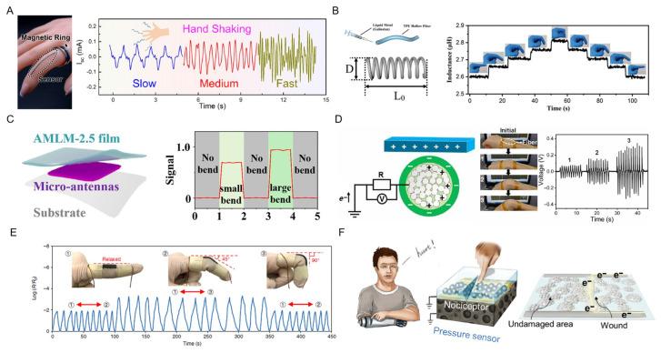 https://cdn.ncbi.nlm.nih.gov/pmc/blobs/8c24/9856137/694adb90e6be/biosensors-13-00084-g012.jpg