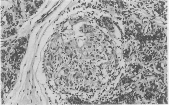 https://cdn.ncbi.nlm.nih.gov/pmc/blobs/8c25/499843/c69fbd80d23e/jclinpath00199-0094-a.jpg