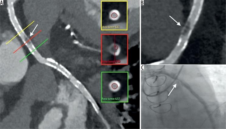 https://cdn.ncbi.nlm.nih.gov/pmc/blobs/8c26/7016499/3587fa866ad9/PJR-84-39425-g006.jpg