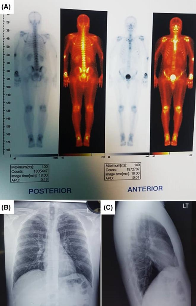 https://cdn.ncbi.nlm.nih.gov/pmc/blobs/8c27/11052681/5e3f245754ea/CCR3-12-e8830-g003.jpg