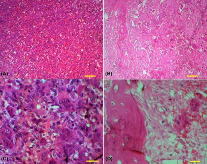 https://cdn.ncbi.nlm.nih.gov/pmc/blobs/8c27/11052681/afe030c4df2e/CCR3-12-e8830-g002.jpg