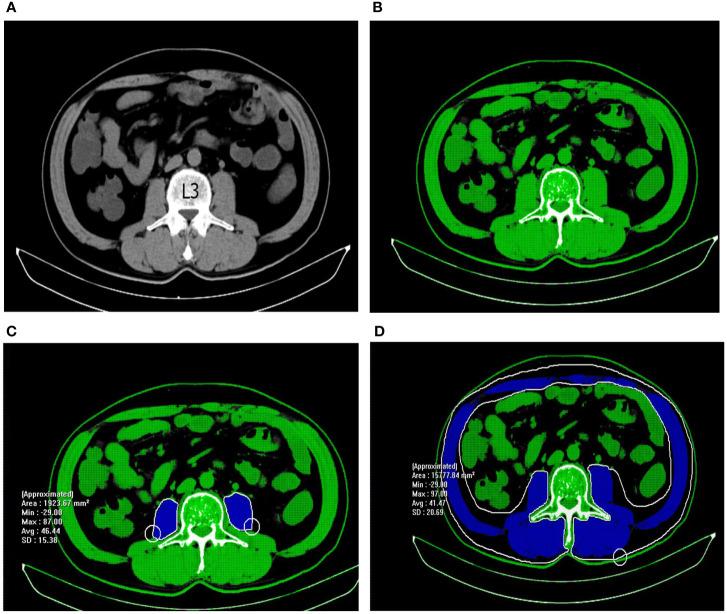 https://cdn.ncbi.nlm.nih.gov/pmc/blobs/8c28/10539580/dfe1999094a9/fonc-13-1189324-g001.jpg