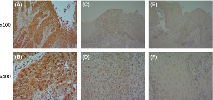 https://cdn.ncbi.nlm.nih.gov/pmc/blobs/8c2c/7105841/d8d91b4f8484/AGS3-4-135-g001.jpg