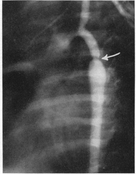 https://cdn.ncbi.nlm.nih.gov/pmc/blobs/8c2f/1512029/ab579af83ce3/califmed00201-0091-b.jpg