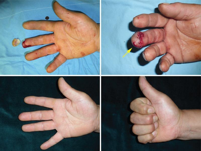 https://cdn.ncbi.nlm.nih.gov/pmc/blobs/8c3d/4937911/49ad3747faed/medi-95-e3979-g002.jpg