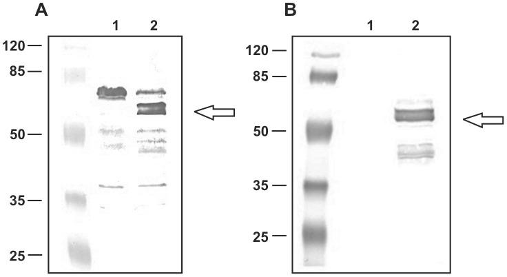 https://cdn.ncbi.nlm.nih.gov/pmc/blobs/8c48/3990602/11bcb6c5fe37/pone.0095187.g004.jpg