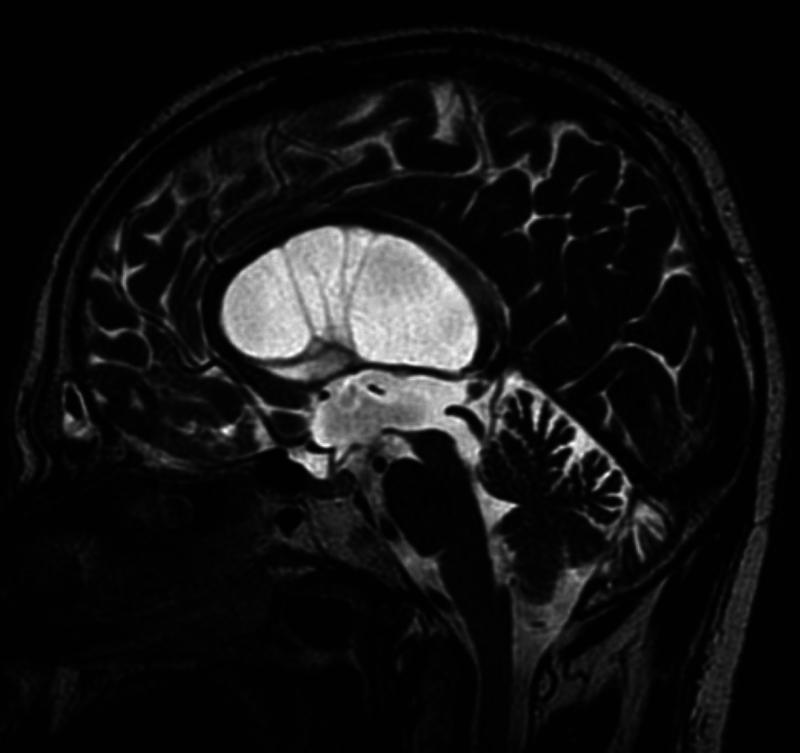 https://cdn.ncbi.nlm.nih.gov/pmc/blobs/8c49/12278952/d39af20d6cd6/CASE2531_figure_1.jpg