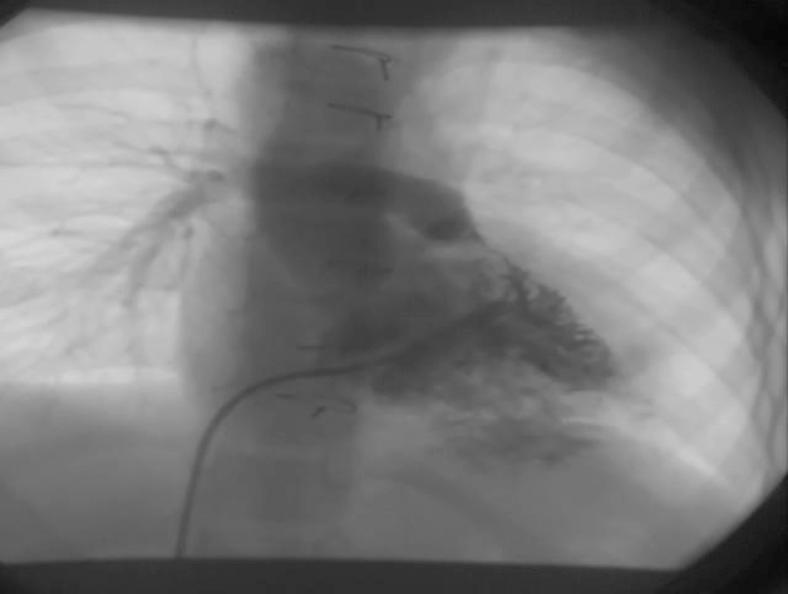 https://cdn.ncbi.nlm.nih.gov/pmc/blobs/8c4f/4359597/4a897244fb25/IJPD-24-119-g001.jpg