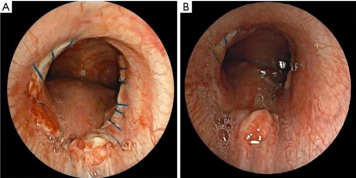 https://cdn.ncbi.nlm.nih.gov/pmc/blobs/8c58/12433090/1029128944ad/tp-14-08-2047-f2.jpg