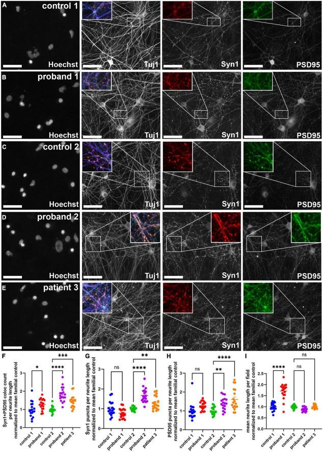 https://cdn.ncbi.nlm.nih.gov/pmc/blobs/8c59/9669751/ca0e40e2edce/fpsyt-13-924956-g004.jpg