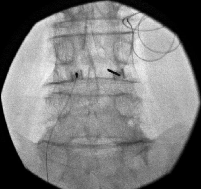 https://cdn.ncbi.nlm.nih.gov/pmc/blobs/8c66/9477135/6a34b81d5668/toj-21-0115-figure4.jpg