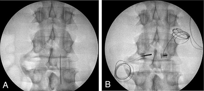https://cdn.ncbi.nlm.nih.gov/pmc/blobs/8c66/9477135/71858e3dae32/toj-21-0115-figure5.jpg