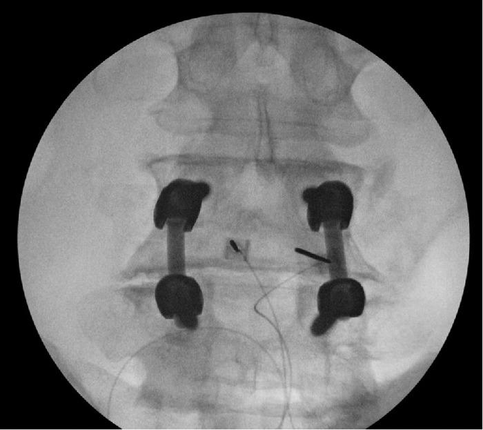 https://cdn.ncbi.nlm.nih.gov/pmc/blobs/8c66/9477135/bad8846ed335/toj-21-0115-figure2.jpg