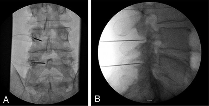 https://cdn.ncbi.nlm.nih.gov/pmc/blobs/8c66/9477135/fe28ab4ba363/toj-21-0115-figure1.jpg