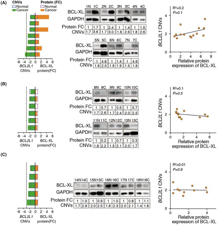 https://cdn.ncbi.nlm.nih.gov/pmc/blobs/8c6a/10272913/69a5519ec4d4/AME2-6-245-g001.jpg
