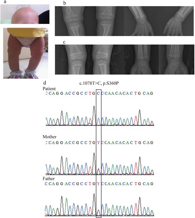 https://cdn.ncbi.nlm.nih.gov/pmc/blobs/8c6a/5505967/b36b08935b6b/41598_2017_5081_Fig1_HTML.jpg