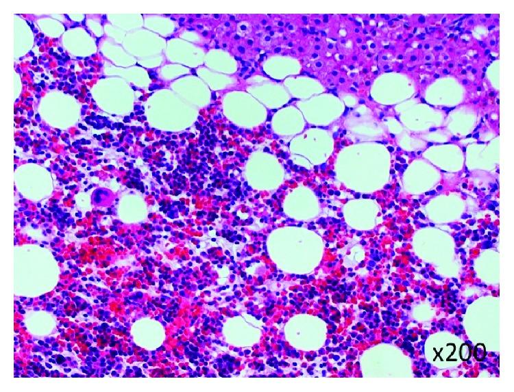 https://cdn.ncbi.nlm.nih.gov/pmc/blobs/8c70/6016169/829970e7c999/CRIS2018-4854368.005.jpg