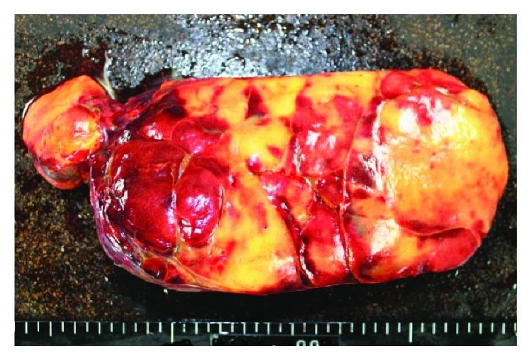 https://cdn.ncbi.nlm.nih.gov/pmc/blobs/8c70/6016169/f9a500ea5072/CRIS2018-4854368.004.jpg